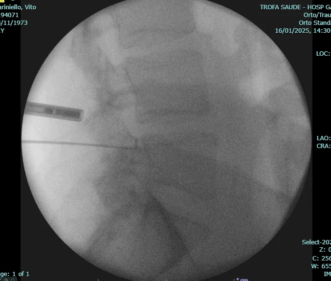 Imagem intra-operatória